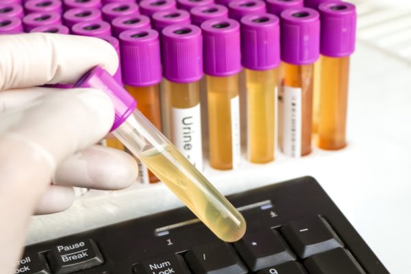 Analisi urine Analisi di laboratorio Zenit
