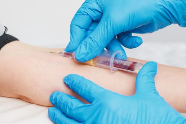 Prelievi sangue Analisi di laboratorio Zenit